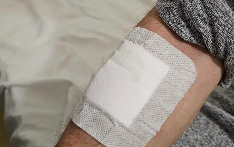 Imagen de una de las heridas de una v&iacute;ctima de un robo con violencia en Zaragoza capital /H.A.
