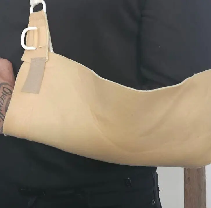Imagen del brazo lesionado al detener una agresi&oacute;n presuntamente realizada con un cuchillo /H.A.