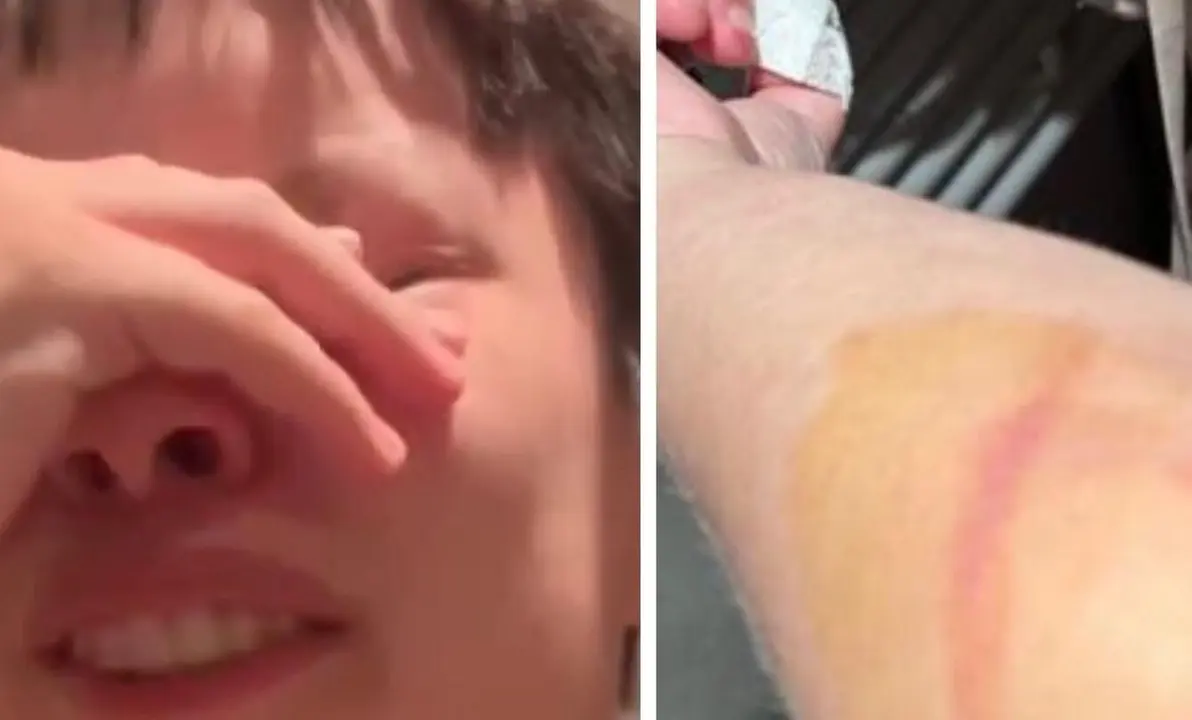 Imagen de las heridas y de la frustraci&oacute;n de esta v&iacute;ctima del ataque/ Cedidas a H.A.