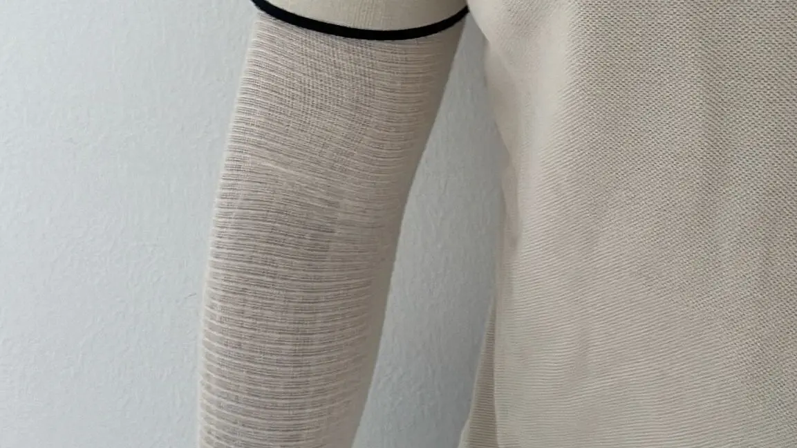 Imagen del brazo vendado de uno de los funcionarios agredidos/ H.A.
