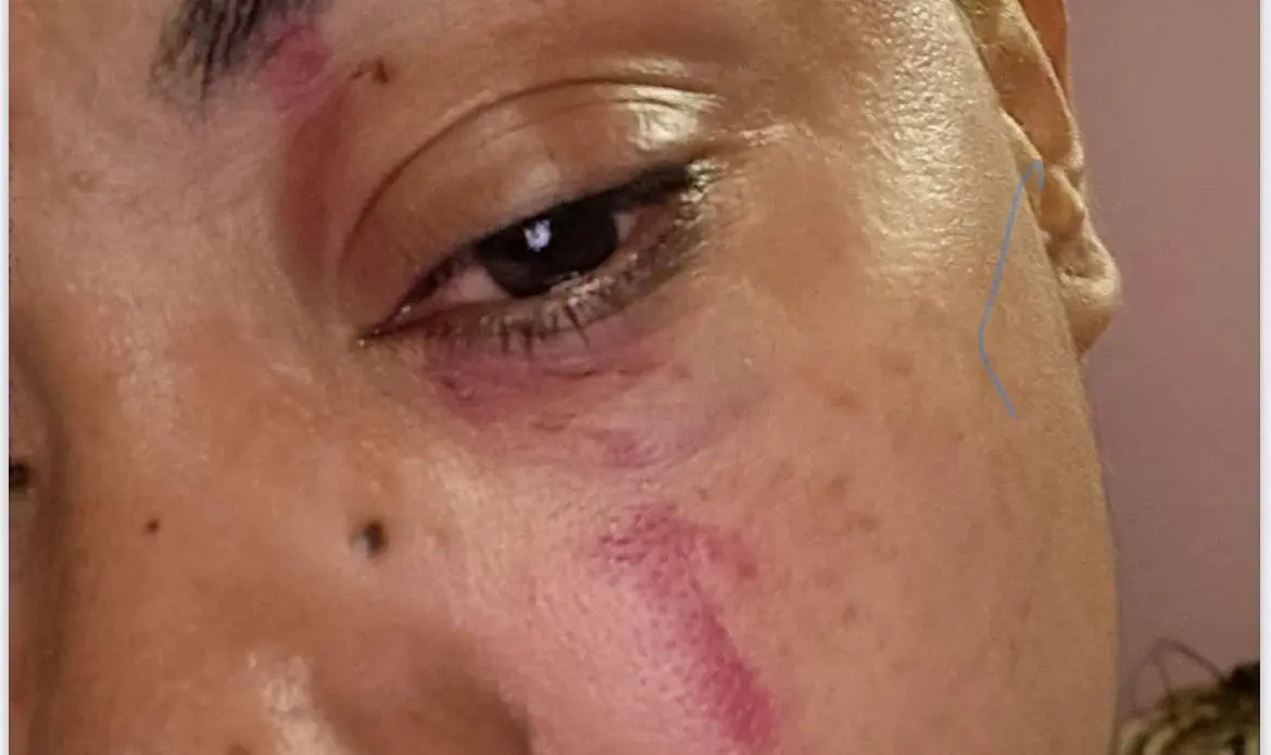 Imagen de las heridas en la cara de una de las v&iacute;ctimas /Cedida a H.A.