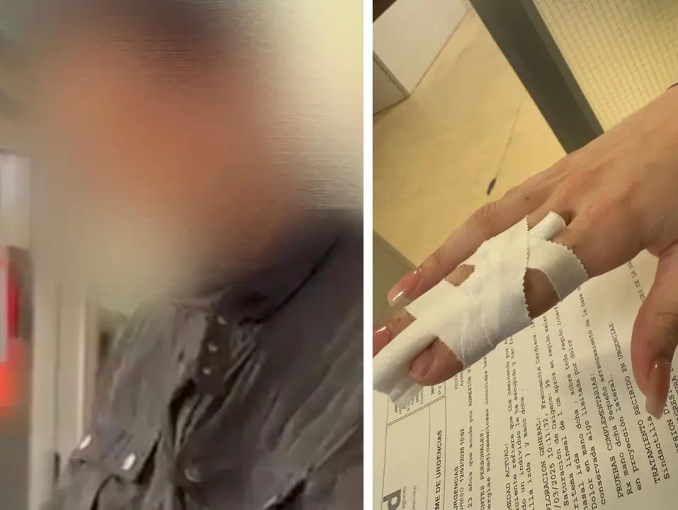 Imagen del detenido y de la lesi&oacute;n que caus&oacute; en un dedo a una de las chicas /H.A.