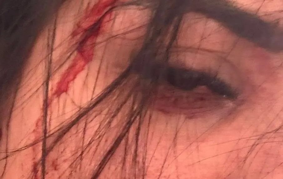 Imagen de la v&iacute;ctima con la cara ensangrentada y moratones por el cuerpo/ Cedida a H.A.
