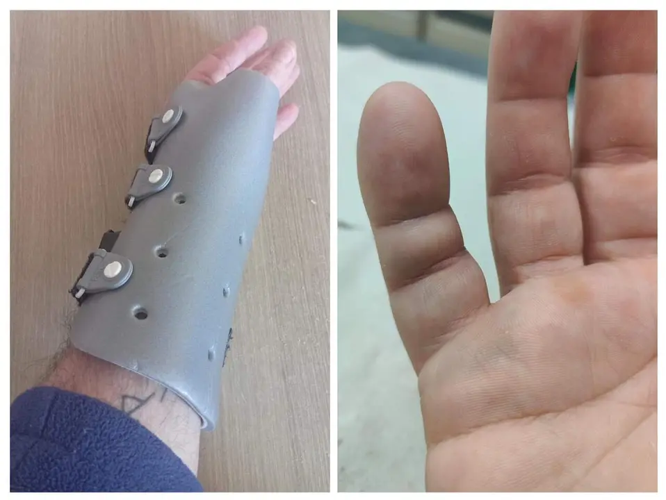 Im&aacute;genes de lesiones de vigilantes de seguridad en el ejercicio de sus funciones en Zaragoza/ Cedidas a H.A.