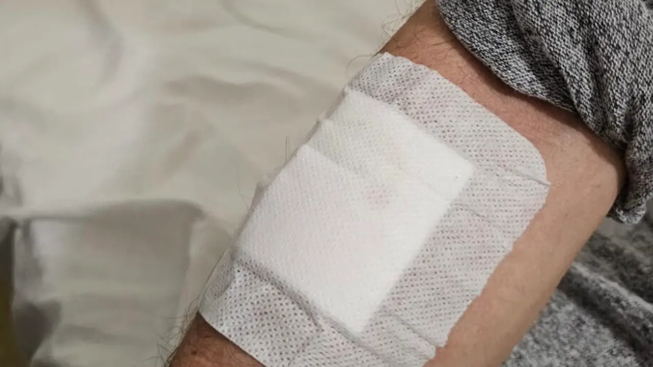 Imagen de una de las heridas de una v&iacute;ctima de un robo con violencia en Zaragoza capital /H.A.