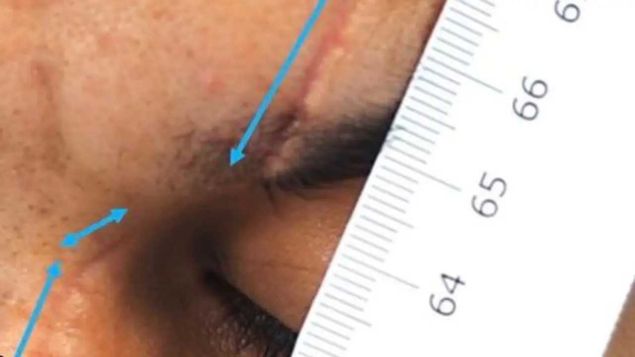 Imagen del rostro de la v&iacute;ctimas con las secuelas en la cara /Cedidas a H.A.
