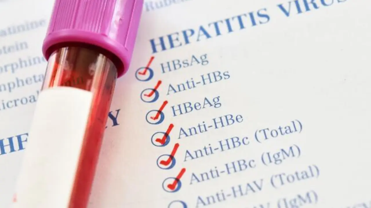 Hepatitis