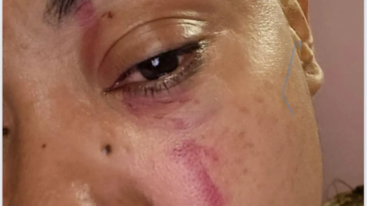 Imagen de las heridas en la cara de una de las v&iacute;ctimas /Cedida a H.A.
