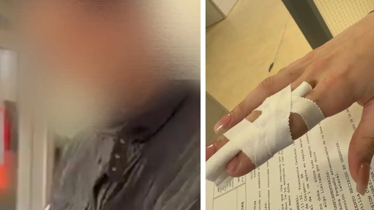 Imagen del detenido y de la lesi&oacute;n que caus&oacute; en un dedo a una de las chicas /H.A.
