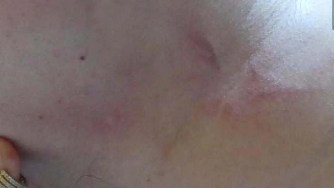 Imagen de parte de las presuntas agresiones sufridas por la v&iacute;ctima/Cedida a H.A.